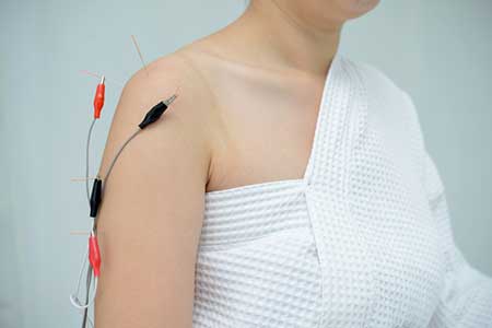 How Electro-Acupuncture Can Help You Recover from an Injury